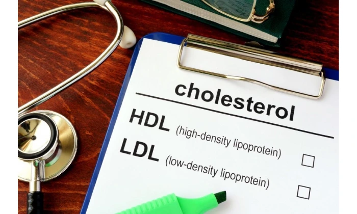 أفضل مختبر لإجراء تحاليل ldl و hdl