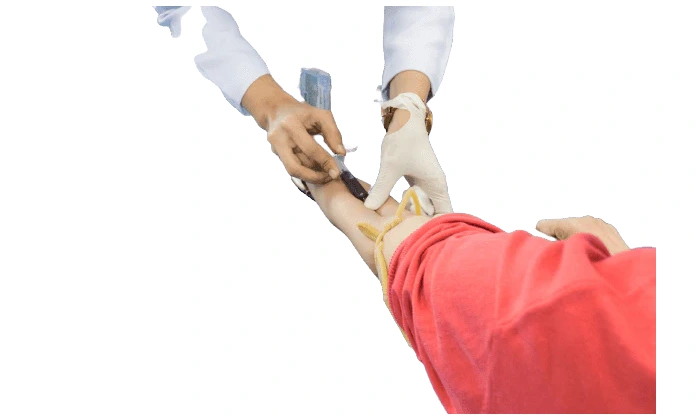 إجراء تحليل الكوليسترول النافع (HDL)
