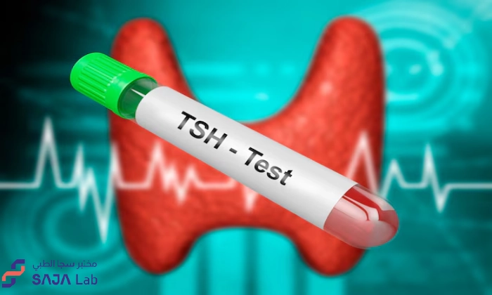 اسباب ارتفاع ال tsh و متى يكون ارتفاع tsh خطير